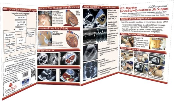 FEEL - ALS-konforme Echokardiographie für Notfälle - Pocket Card, 8-seitig, 8. Auflage (2022)