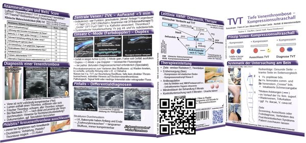 jetzt mit Filmen - über QR Code - TVT  - Sonoskopie Pocket Card, 8-seitig, 6. Auflage (2023)
