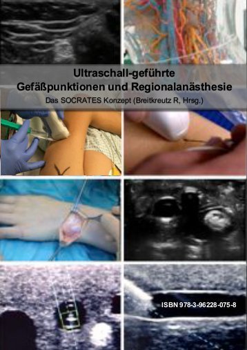 Ultraschall-geführte Gefäßpunktionen u. -Regionalanästhesie - Kurzlehrbuch "SOCRATES" Konzept