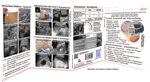 Wegweiser Magen-Darm Ultraschall akut- Pocket Card, 8-seitig. 3. Auflage (2022)