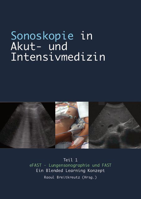 Sonoskopie in Akut- u. Intensivmedizin - Teil 1: Airway, Lunge, Thorax u. eFAST - Notfallsonographie